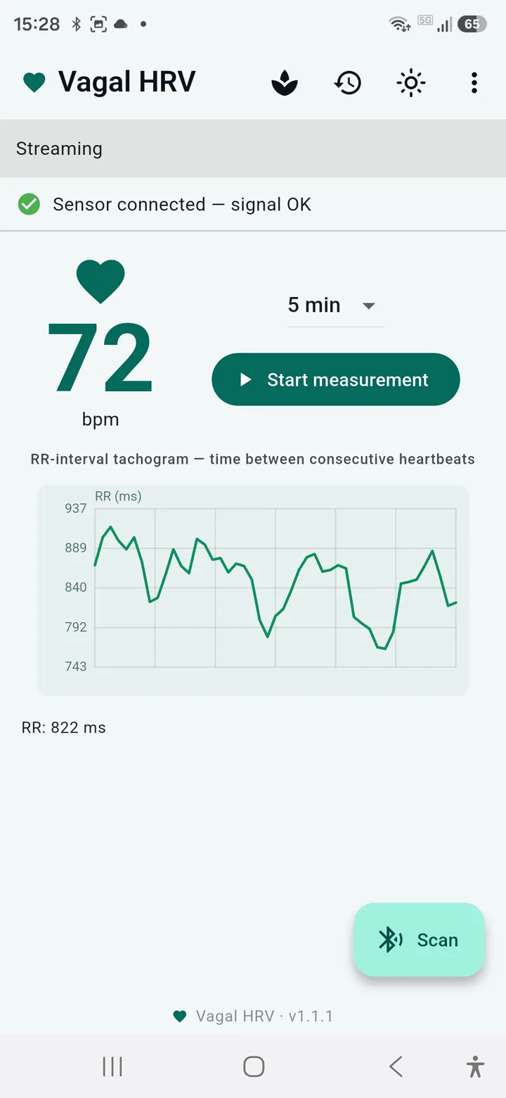 Live heart rate and RR tachogram on the Vagal HRV home screen